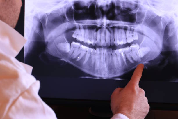 Best Emergency Tooth Extraction in Random Lake, WI